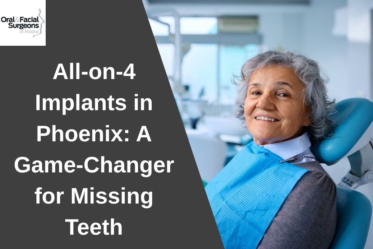 Why Choose All-on-4 Implants for Missing Teeth?