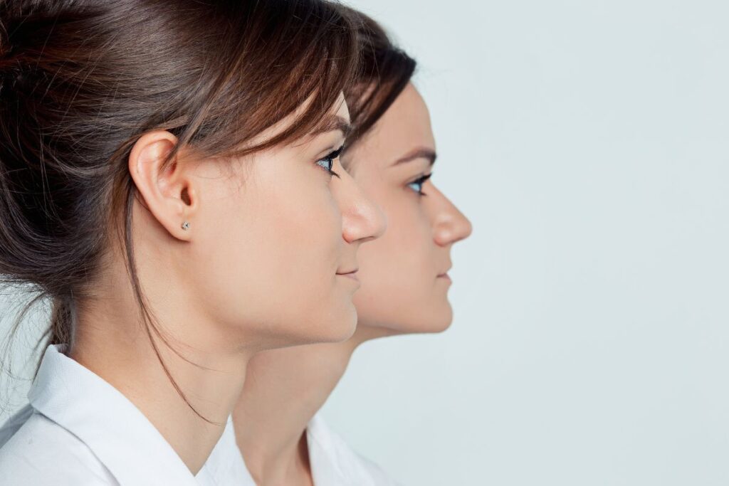 Patient undergoing an evaluation to determine if Corrective Jaw Surgery is needed