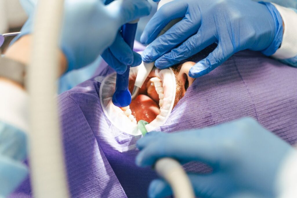 wisdom teeth extraction phoenix recovery timeline